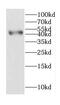 Cell Growth Regulator With Ring Finger Domain 1 antibody, FNab01627, FineTest, Western Blot image 