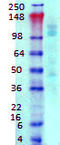 Gamma-aminobutyric acid type B receptor subunit 1 antibody, TA326530, Origene, Western Blot image 
