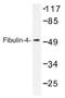 EGF Containing Fibulin Extracellular Matrix Protein 2 antibody, AP01398PU-N, Origene, Western Blot image 