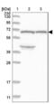 Kelch Like Family Member 36 antibody, NBP1-92059, Novus Biologicals, Western Blot image 