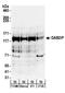 Disabled homolog 2-interacting protein antibody, A302-439A, Bethyl Labs, Western Blot image 
