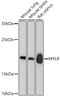 Myosin Light Chain 9 antibody, 18-915, ProSci, Western Blot image 