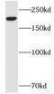 hIRAS antibody, FNab05740, FineTest, Western Blot image 