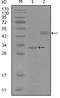 Quiescin Sulfhydryl Oxidase 1 antibody, STJ98395, St John