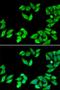 Ribosomal Protein S14 antibody, LS-C334908, Lifespan Biosciences, Immunofluorescence image 
