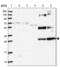 Nuclear Receptor Interacting Protein 2 antibody, NBP1-85033, Novus Biologicals, Western Blot image 