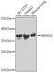 Annexin A2 antibody, GTX32446, GeneTex, Western Blot image 