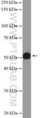 DNA Methyltransferase 1 Associated Protein 1 antibody, 10411-1-AP, Proteintech Group, Western Blot image 