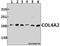 Collagen Type IV Alpha 2 Chain antibody, A02453, Boster Biological Technology, Western Blot image 