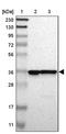 Capping Actin Protein Of Muscle Z-Line Subunit Alpha 2 antibody, PA5-52438, Invitrogen Antibodies, Western Blot image 