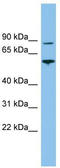 VPS52 Subunit Of GARP Complex antibody, TA344675, Origene, Western Blot image 