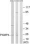 Peroxisomal Membrane Protein 4 antibody, LS-C199504, Lifespan Biosciences, Western Blot image 