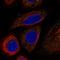 B-Raf Proto-Oncogene, Serine/Threonine Kinase antibody, HPA071048, Atlas Antibodies, Immunofluorescence image 