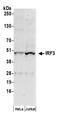 Interferon Regulatory Factor 3 antibody, A300-426A, Bethyl Labs, Western Blot image 