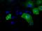 Intraflagellar Transport 57 antibody, GTX84310, GeneTex, Immunocytochemistry image 