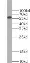 NADPH Oxidase 4 antibody, FNab05806, FineTest, Western Blot image 