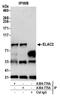Zinc phosphodiesterase ELAC protein 2 antibody, A304-774A, Bethyl Labs, Immunoprecipitation image 