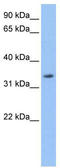 Lactamase Beta antibody, TA340211, Origene, Western Blot image 