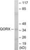 Tumor Protein P53 Inducible Protein 3 antibody, EKC1847, Boster Biological Technology, Western Blot image 