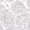 Nanog Homeobox antibody, NBP2-61428, Novus Biologicals, Immunohistochemistry paraffin image 