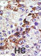 Ubiquitin Conjugating Enzyme E2 E3 antibody, abx031562, Abbexa, Immunohistochemistry paraffin image 