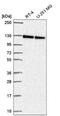 Nucleolar Protein 6 antibody, NBP2-57528, Novus Biologicals, Western Blot image 