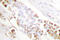 X-Ray Repair Cross Complementing 1 antibody, LS-C176370, Lifespan Biosciences, Immunohistochemistry paraffin image 