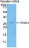 Pentraxin 3 antibody, LS-C295777, Lifespan Biosciences, Western Blot image 