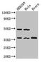 Protein Phosphatase 1 Catalytic Subunit Gamma antibody, CSB-PA018505LA01HU, Cusabio, Western Blot image 