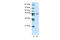 Zinc Finger Protein 558 antibody, 29-133, ProSci, Western Blot image 