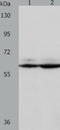 Proteasome 26S Subunit, Non-ATPase 3 antibody, TA321528, Origene, Western Blot image 