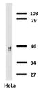Keratin 18 antibody, SM3043B, Origene, Western Blot image 
