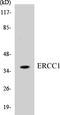 ERCC Excision Repair 1, Endonuclease Non-Catalytic Subunit antibody, EKC1199, Boster Biological Technology, Western Blot image 