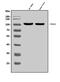 Discs Large MAGUK Scaffold Protein 4 antibody, A02128, Boster Biological Technology, Western Blot image 