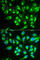 Solute carrier family 22 member 5 antibody, A1676, ABclonal Technology, Immunofluorescence image 