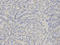 Thromboxane A Synthase 1 antibody, A04697, Boster Biological Technology, Immunohistochemistry paraffin image 