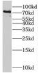 MX Dynamin Like GTPase 1 antibody, FNab05450, FineTest, Western Blot image 
