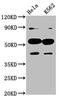 Cytochrome P450 Family 7 Subfamily A Member 1 antibody, CSB-PA006460LA01HU, Cusabio, Western Blot image 