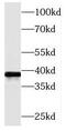 Methionine adenosyltransferase 2 subunit beta antibody, FNab05028, FineTest, Western Blot image 