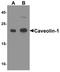 Caveolin 1 antibody, TA355003, Origene, Western Blot image 