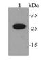 Nuclear Factor Of Activated T Cells 2 Interacting Protein antibody, orb378344, Biorbyt, Western Blot image 