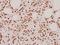 Cardiotrophin 1 antibody, A08056, Boster Biological Technology, Immunohistochemistry paraffin image 