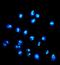 Nucleolar RNA helicase 2 antibody, A04605-2, Boster Biological Technology, Immunofluorescence image 