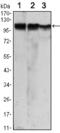 Hexokinase 2 antibody, M01389-1, Boster Biological Technology, Western Blot image 