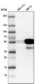 Keratin 7 antibody, HPA007272, Atlas Antibodies, Western Blot image 