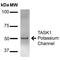 Potassium channel subfamily K member 3 antibody, MA5-27677, Invitrogen Antibodies, Western Blot image 