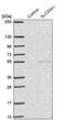 Solute Carrier Family 33 Member 1 antibody, PA5-59976, Invitrogen Antibodies, Western Blot image 