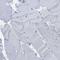 Delta/Notch Like EGF Repeat Containing antibody, NBP1-88665, Novus Biologicals, Immunohistochemistry paraffin image 