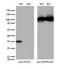 Pyridoxal kinase antibody, M06683-1, Boster Biological Technology, Western Blot image 