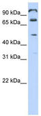 Family With Sequence Similarity 171 Member A1 antibody, TA336124, Origene, Western Blot image 